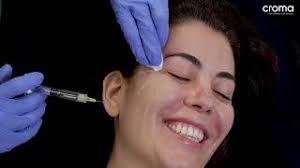 Tratamiento PhilArt Eye en la zona periocular