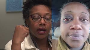 Grand Mal Seizure Watch till the end