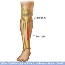 Page Not Found Site Help Shin Splints Shin Splints Treatment Shin Splint Exercises