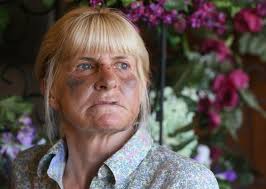 Maybe you would like to learn more about one of these? Barberton Woman Recovering From Vicious Attack At Her Business