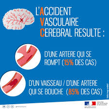 La prise de traitements anticoagulants et antiagrégants plaquettaires (aspirine. Les Signes De L Avc Ministere Des Solidarites Et De La Sante