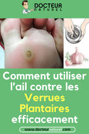 Pin On Sante Bien Etre Et Remise En Forme