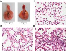 Labeling in histology of tissue samples at each step of the process is critical to the interpretation of results, necessary to accurately diagnose patients. Plos One Pulmonary Permeability Assessed By Fluorescent Labeled Dextran Instilled Intranasally Into Mice With Lps Induced Acute Lung Injury