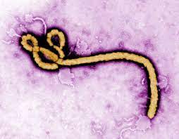 Check spelling or type a new query. Ebola Hiv Influenza Wie Viren Unter Dem Mikroskop Aussehen Der Spiegel
