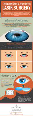 Lasik Surgery Lasik Surgery Lasik Pediatric Ophthalmology