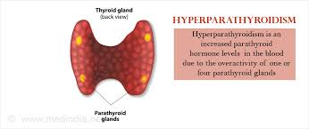 Hair loss sometimes occurs if the thyroid gland is not working correctly. Hyperparathyroidism Causes Symptoms Diagnosis Treatment Prevention