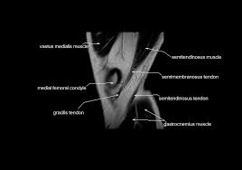Learn anatomy using a full pacs! Mri Knee Anatomy Knee Sagittal Anatomy Free Cross Sectional Anatomy