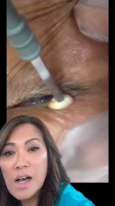 Dr Sandra Lee aka drpimplepopper