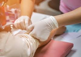 Image result for Venous Blood Sampling