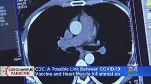 Strongly recommends covid vaccines for americans ages 12 and older. Byiq50xqgm8yum