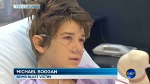 Public raises £19,000 for autistic bomb victim who lost his fingers after  attack by bullies