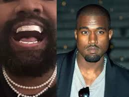 kanye west: Kanye West gets titanium dentures modeled after James Bond  villain. Its cost will shock you - The Economic Times