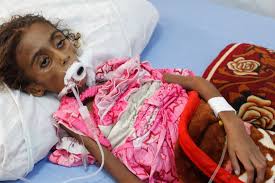War-torn Yemen is facing a man-made famine of Biblical proportions,' says  aid expert