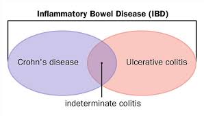 Inflammatory Bowel Disease Ibd Diagnosis And Treatment