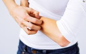 أسباب حكة الجسم في الليل وعند النوم المدينة نيوز