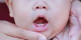 Maybe you would like to learn more about one of these? Usia Tumbuh Gigi Bayi Berbeda Beda Ini Yang Perlu Diketahui Mom