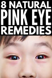 Home Remedies For Pink Eye 8 Natural Remedies For Pink Eye That Work Pinkeye Remedies Pink Eyes Natural Pink Eye Remedy