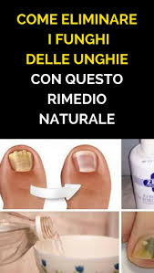 Questa Semplice Miscela Elimina Rapidamente I Funghi Delle Unghie Dei Piedi E Delle Mani Rimedi Rimedi Naturali Unghie Malattie