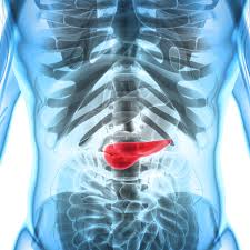 Like all canine cancers this is a very difficult disease for the dog owner to cope with. Are Functional Bowel Disorders Often Mistaken For Chronic Pancreatitis