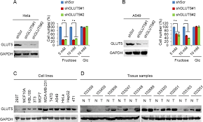Get to know more on gemini likes on love, friends, public and personal life. Down Regulated Glut5 And Its Affection In Other Cancer Cell Lines A Download Scientific Diagram