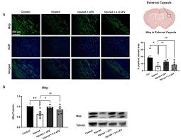 Image result for karp ln  tunel ort za