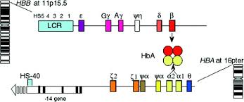 Beta thalassemia major causes hemolytic anemia, poor growth, and skeletal abnormalities during infancy. Beta Thalassemia Genetics In Medicine