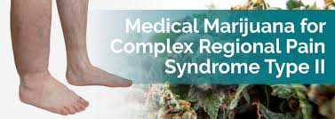 Medical Marijuana For Crps Type Ii Marijuana Doctors