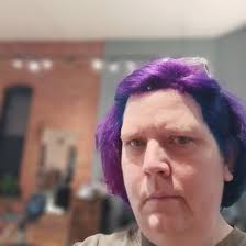 Does a broken toe stop you from being active