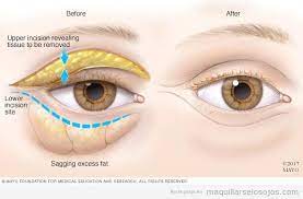 Maquillarse Los Ojos Maquillaje De Ojos Paso A Paso Trucos E Ideas Tecnicas Y Videotutoriales Tratamiento Bolsas Ojos Bolsas De Ojos Ojos Hinchados