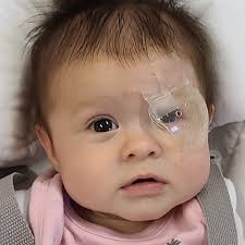 Fundraiser by Lynn Meade : Help Hope See the World Clearly