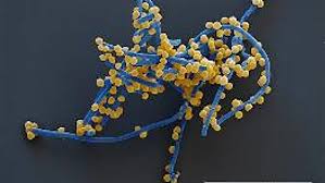 A special problem is posed by glycopeptide intermediate susceptible s. Us Patent Fur Probiotikum Gegen Mrsa Keime Apotheke Adhoc