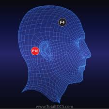 Tdcs Electrode Placement Montage Guide Total Tdcs