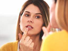 Maybe you would like to learn more about one of these? How To Get Rid Of A Cold Sore Fast Treatments And Home Remedies