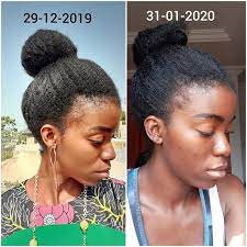 How To Grow 4c Edges Protective Braids Natural Hair Styles Thinning Edges