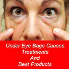 Under Eye Bags Treatments Causes And Best Cream Eye Bags Treatment Under Eye Bags Eye Bags