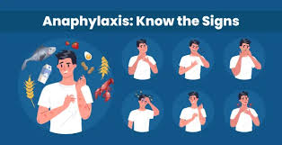 Image result for Anaphylaxis