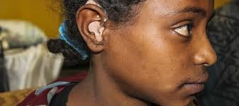 Hearing aid systems in low- resource settings