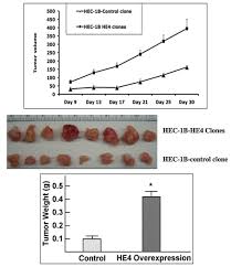 Endometriosis is more common in women who are having fertility issues, but it does not necessarily cause infertility. He4 Tumor Marker Endometrial Cancer Serum He4 Marker For Recurrent Endometrial Cancer