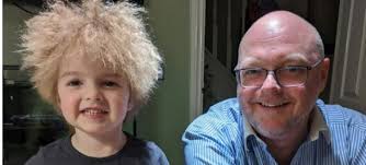 Dziewczynka cierpi na bardzo rzadką chorobę. "Ma fryzurę jak Einstein"