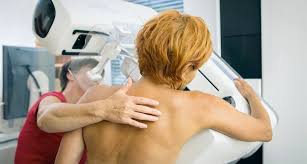 Ab wann frauen zur vorsorge gehen sollten. Das Mammographie Screening Programm