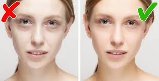 Iron Deficiency Anemia - %