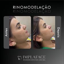 Clínica Implaface (@implaface.arcos) • Instagram photos and videos