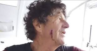 Jean le cam on wn network delivers the latest videos and editable pages for news & events, including entertainment, music, sports, science and more, sign up and share your playlists. Jean Le Cam Attacked By A Flying Fish Today24 News English