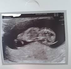 Find the best pregnancy tracker and baby apps for all your mom and dad needs. N2slozbtgbu1qm