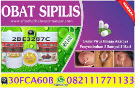 Raja singa atau sifilis adalah penyakit menular seksual yang disebabkan oleh bakteri. Nama Obat Sipilis Kencing Nanah Di Apotik De Nature Herbal Indonesia