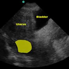 Image result for FAST Exam