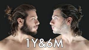 Know your hair growth vitamins. Hair Growth Time Lapse 1 Year 6 Months Bearded Or Shaved Watch These Videos On Youtube It Will Help Explain Hair Growth Hair Loss Men Hair Growth Charts