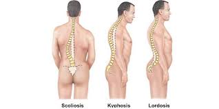Bol V Spine Pri Vdohe Prichiny Simptomy I Lechenie