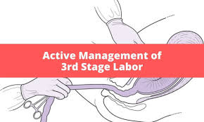 Image result for Active Management of Labor