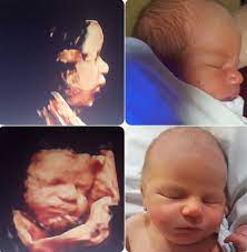 3d 4d Ultrasound Cost Price Youngstown Boardman Ohio